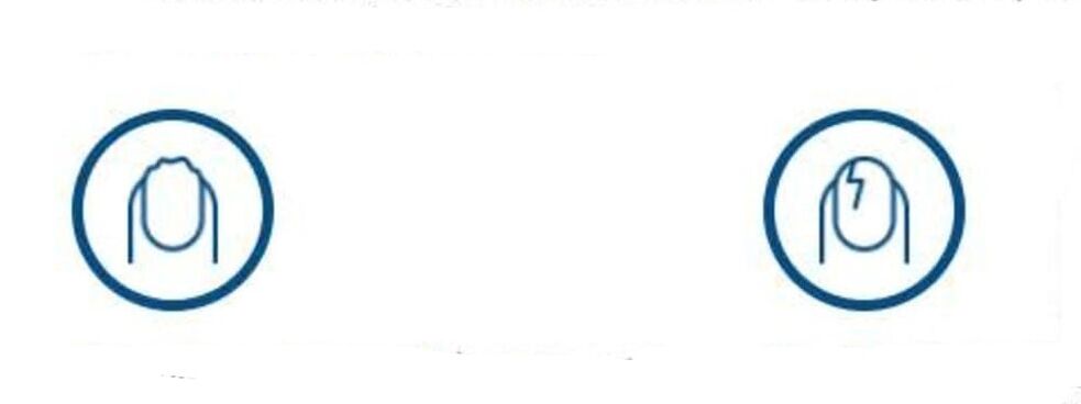 deformación das uñas por infección por fungos